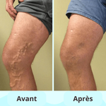 Charger l&#39;image dans la galerie, Tapis de Massage Conductif EMS
