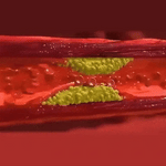 Charger l&#39;image dans la galerie, Tapis de Massage Conductif EMS
